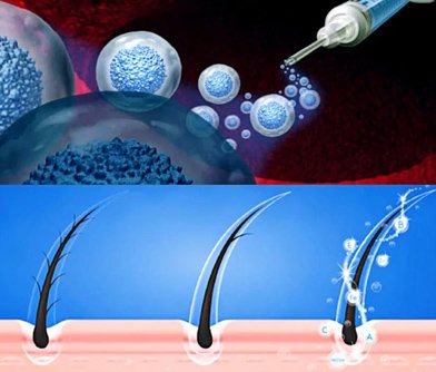 Hair Exosomes