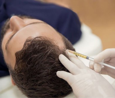 PRP Therapy