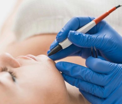 White Hair Removal